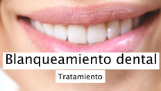 Ir a Blanqueamiento dental (en el consultorio) con una duración de 1 minuto, 58 segundos
