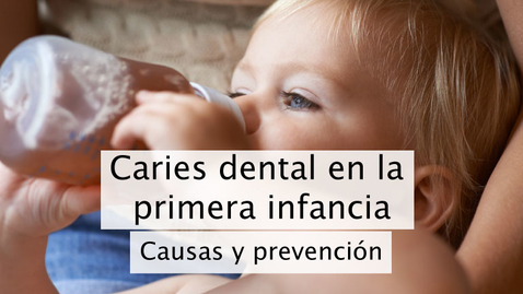 Miniatura para Caries dental en la primera infancia