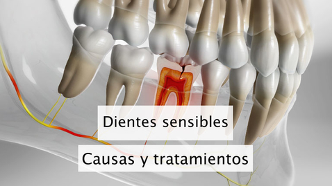 Miniatura para Dientes sensibles