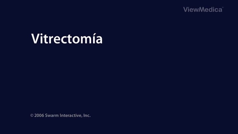 Miniatura para vitrectomía 