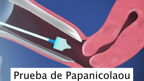 Miniatura para Prueba de Papanicolaou (Pap)