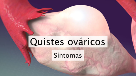 Miniatura para Quistes ováricos