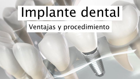 Miniatura para Implante dental