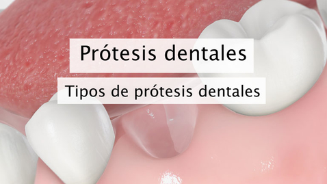 Miniatura para Prótesis dentales