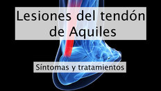 Ir a Lesiones del tendón de Aquiles con una duración de 2 minutos, 34 segundos