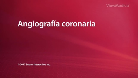 Miniatura para Angiografía coronaria