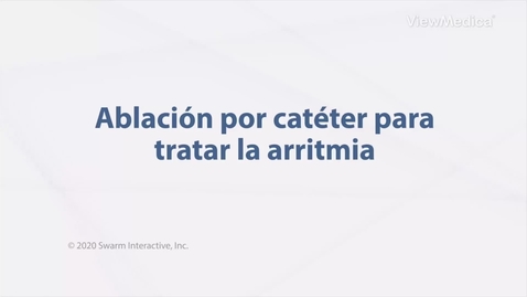 Miniatura para Ablación por catéter para tratar la arritmia
