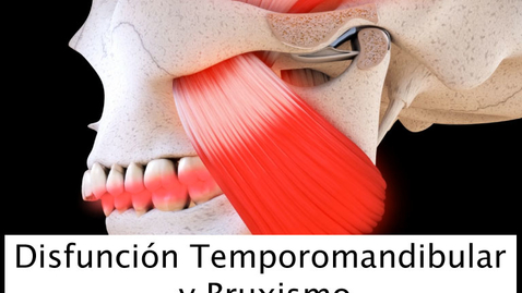 Miniatura para Disfunción Temporomandibular y Bruxismo