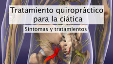 Ir a Tratamiento quiropráctico para la ciática con una duración de 1 minuto, 27 segundos