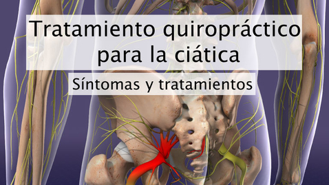 Miniatura para Tratamiento quiropráctico para la ciática