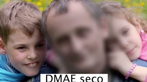 Miniatura para Degeneración macular asociada a la edad, tipo seco -DMAE seca 