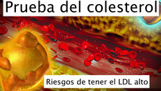 Ir a Prueba de colesterol con una duración de 2 minutos, 8 segundos