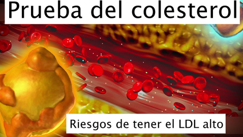 Miniatura para Prueba de colesterol