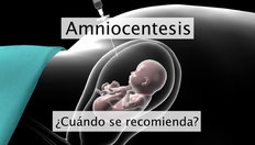 Ir a Amniocentesis con una duración de 2 minutos, 24 segundos