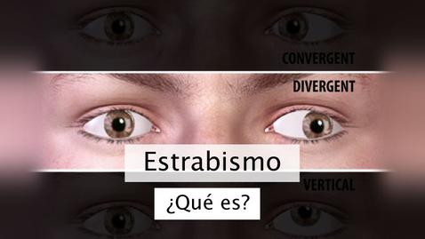 Miniatura para Estrabismo