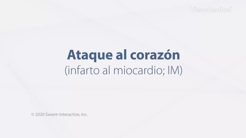 Miniatura para Ataque al corazón