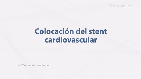 Miniatura para Colocación del stent cardiovascular