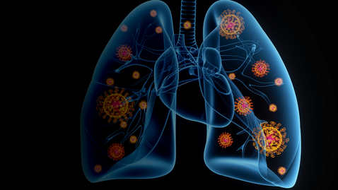 Thumbnail for entry George P. Noon Conference: Lung Transplantation: Charting the way forward in the COVID-19 Era - 11.08.21