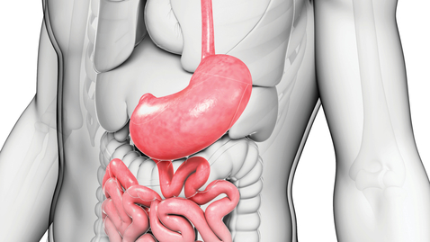 Thumbnail for entry 05- Fundoplication App: Hiatal Closure by Patrick R. Reardon, MD