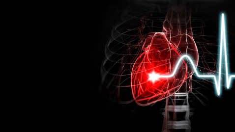 Thumbnail for Grand Rounds with Matthew Jay Budoff, MD 04.23.20