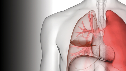 Thumbnail for 5th Annual International Symposium on Advances in Critical Care Medicine (ISAC) - Day 1 - 03.24.23