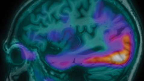 Thumbnail for 12th Annual Nantz National Alzheimer Center Symposium - 02.17.23