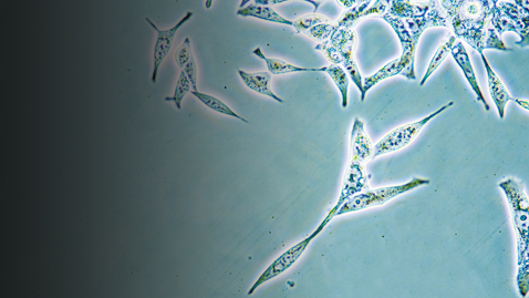 Thumbnail for 11th Annual Houston Methodist Cancer Symposium - 08.11.23