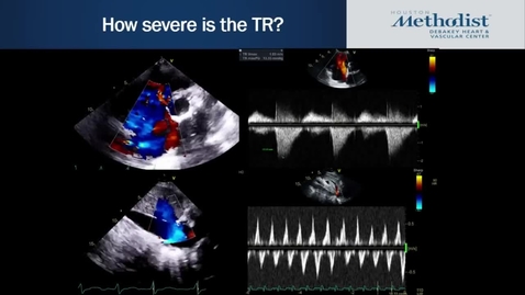 Thumbnail for entry Grand Rounds with Nadeen Faza, MD 5.16.19