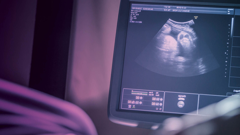 Thumbnail for Obstetric Care of the Jehovah’s Witness Patient with Michael Jones, MD - 09.01.21