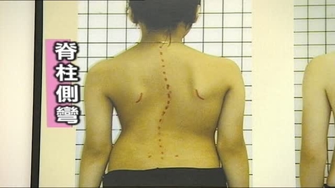 Thumbnail for 姿勢與健康