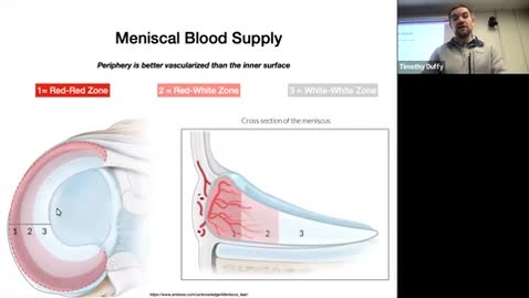 Thumbnail for entry Lecture 12: Knee, Ankle 