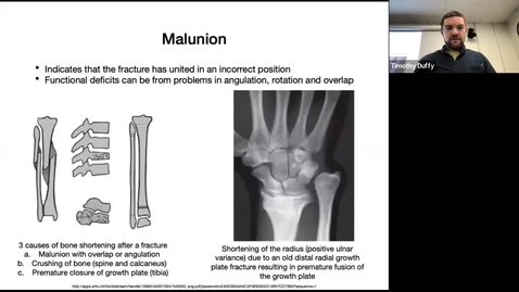 Thumbnail for Lecture 5: Inflammatory bone diseases