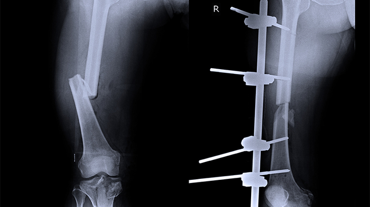 Thumbnail for channel Musculoskeletal Conditions and Management Fall 2022