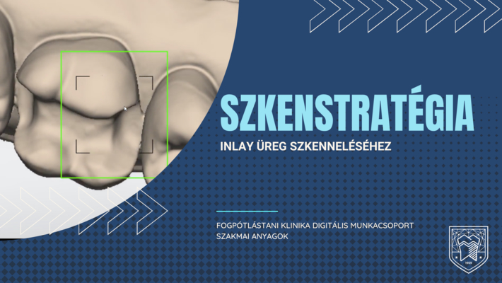 Szken stratégia inlay üreg szkenneléséhez