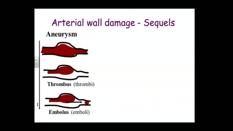 Thumbnail for entry Cardiovascular Lecture 5_MAGR-298LCS_2014-10-09