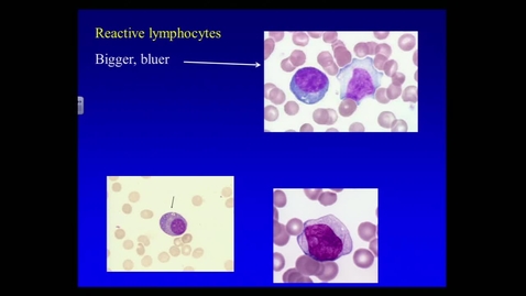 Thumbnail for VMB 763 Lecture 5. January 15, 2014