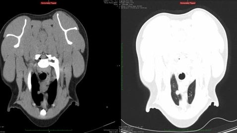 Thumbnail for BVMS5 CT Case 1