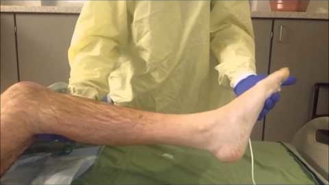 Thumbnail for entry Ankle clonus