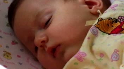 Thumbnail for Neonatal Reflexes