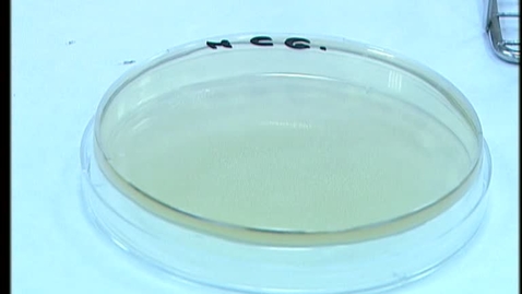 Miniatura para la entrada TÉCNICAS BÁSICAS DE MICROBIOLOGÍA. SIEMBRA Y AISLAMIENTO DE BACTERIAS