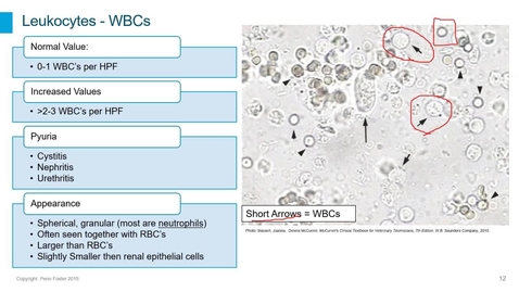 Thumbnail for Clinical Pathology 1 Webinar - Urinalysis Part 3: Microscopic Exam, Part 1