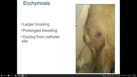 Thumbnail for Adrenaline Rush! Webinar - Heat Stroke