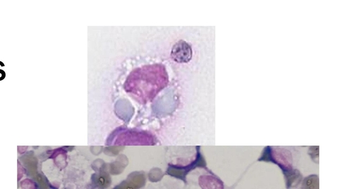 Thumbnail for Cytology Sample Evaluation Part 1