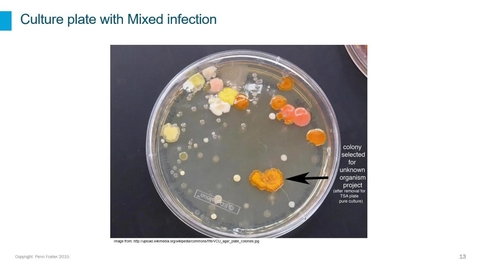 Thumbnail for Clinical Pathology Webinar - Lesson 3: Antibiotic Sensitivity Testing