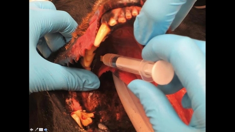 Thumbnail for Anesthetic Considerations for the Dental Patient