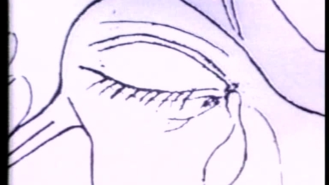 Thumbnail for Lauriane, the astonished heart / Lauriane: all knotted up inside