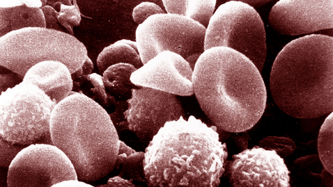 Thumbnail for How the Immune System Works