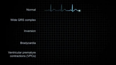 Thumbnail for pfiz_epi_03_06_01_03_vidStep2.flv