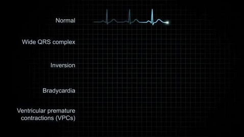 Thumbnail for entry pfiz_epi_03_06_01_03_vidStep2.flv