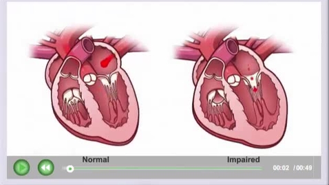 Thumbnail for entry Cardiac_effects_of_overdose.mp4